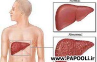 مقاله ای در مورد پیشگیری و درمان کبد چرب
